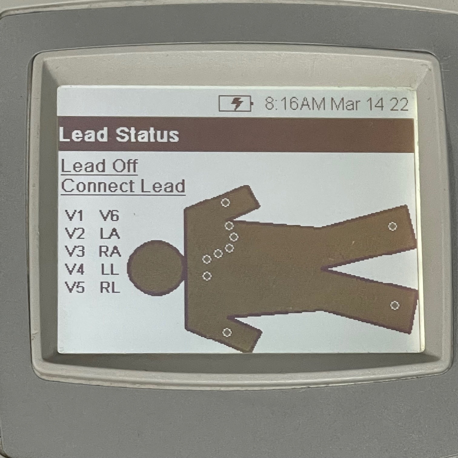 Welch Allyn Cp 100 ECG Price